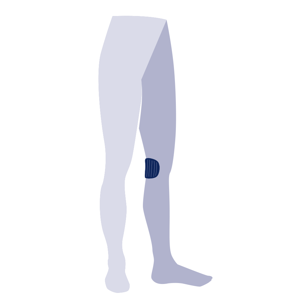 Oval Pad